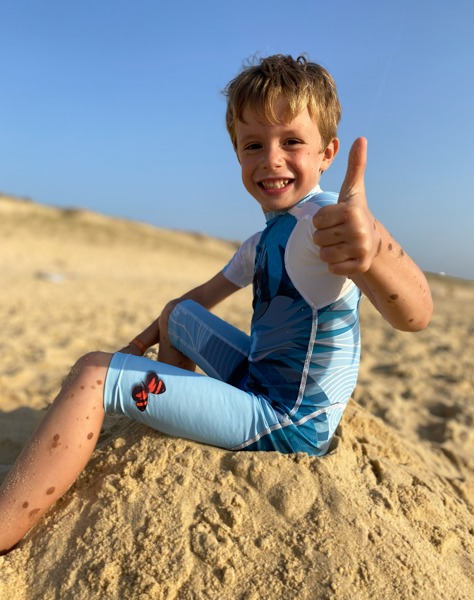 Léonard, naevus congénital — porte une combinaison UVEA UPF 80